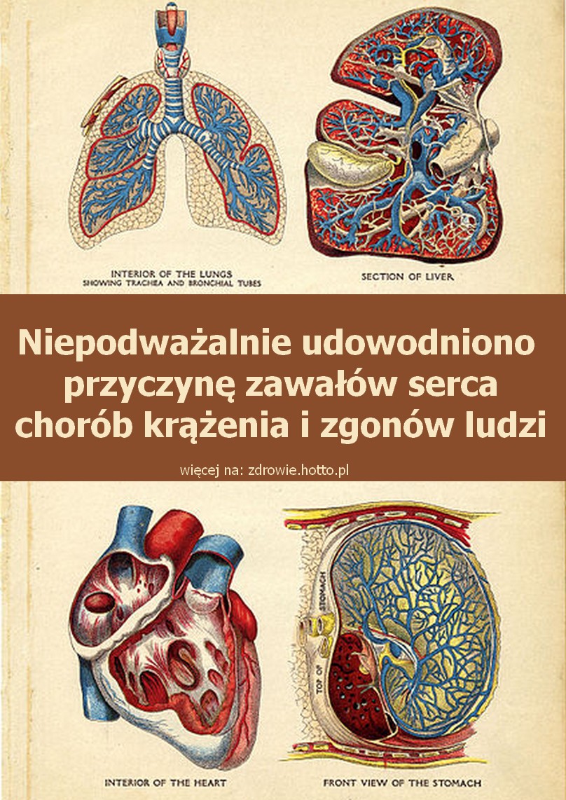 zdrowie.hotto.pl-udowodniono-przyczyne-zawalow-serca-chorob-krazenia-smierci-ludzi
