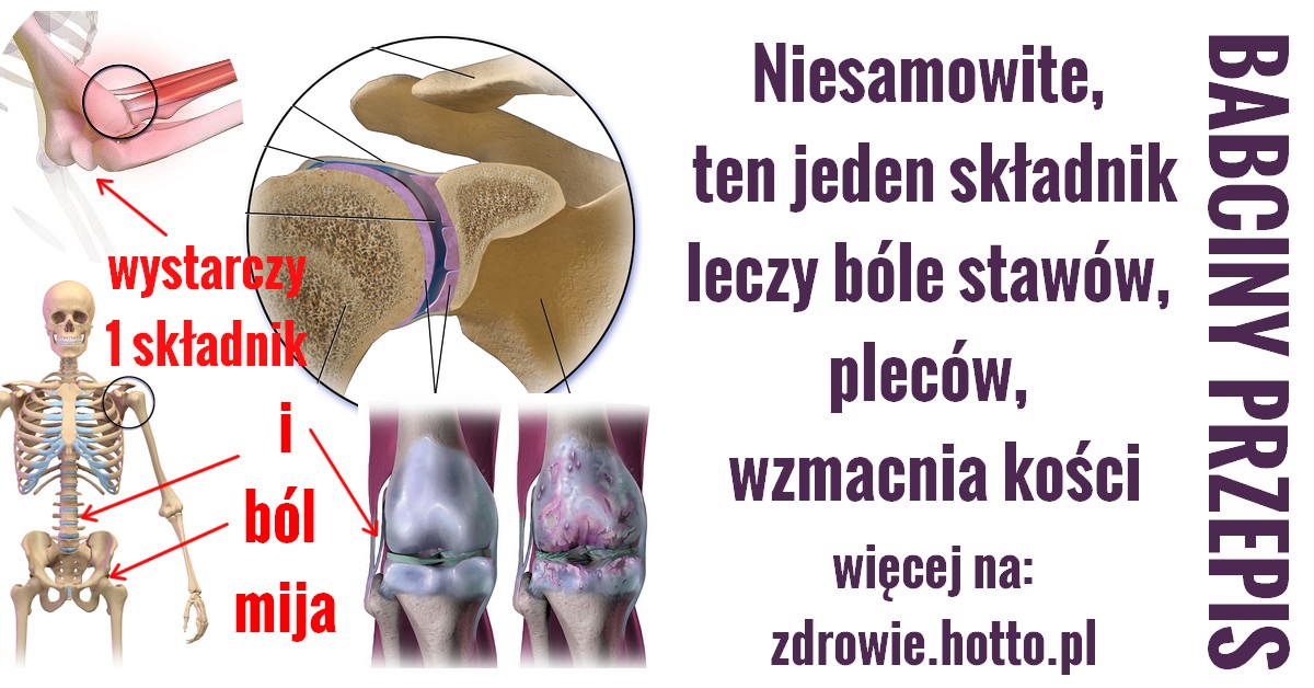 zdrowie.hotto.pl-na-bole-stawow-kolan-kregoslupa-plecow-wystarczy-1-skladnik-PRZEPIS