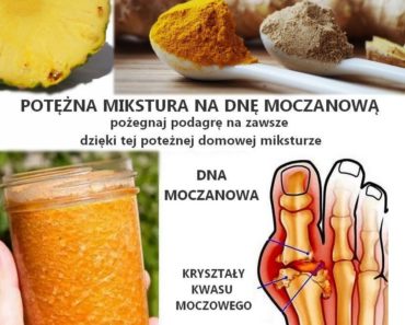 zdrowie.hotto.pl-dna-moczanowa-podagra-leczenie-mikstura-domowy-sposob