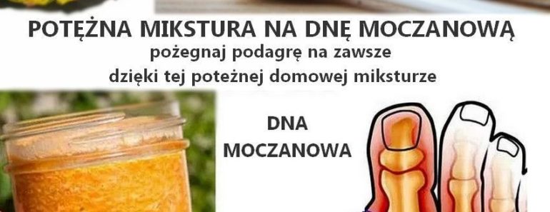 zdrowie.hotto.pl-dna-moczanowa-podagra-leczenie-mikstura-domowy-sposob