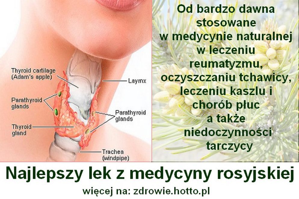 zdrowie.hotto.pl-domowy-sposob-na-niedoczynnosc-tarczycy-lek-rosyjskiej-medycyny-ludowej