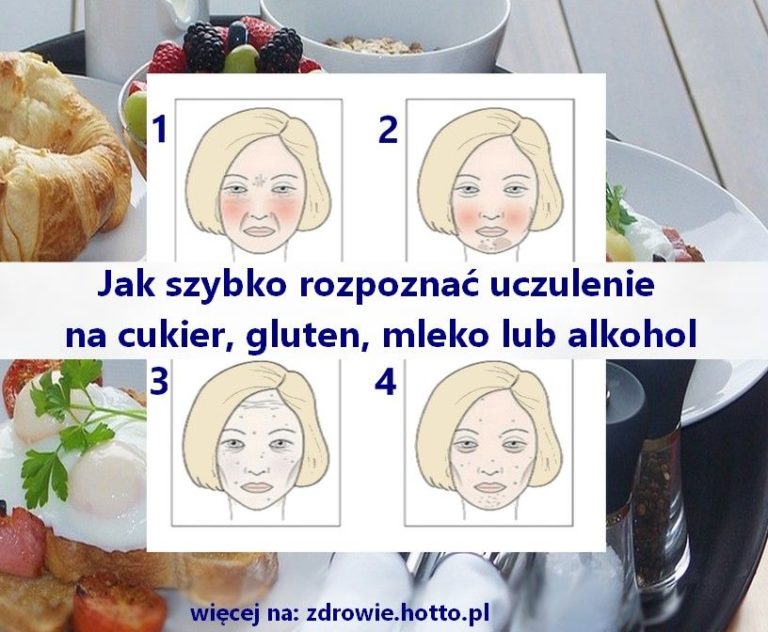 Jak Szybko Rozpoznać Uczulenie Na Gluten Cukier Mleko Lub Alkohol Przydatne Zdrowiehottopl 3112