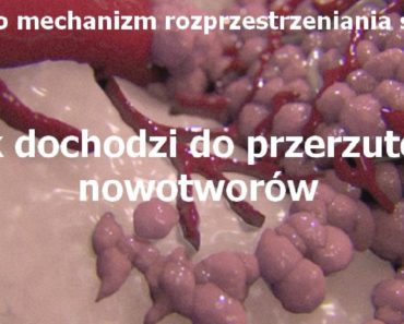 zdrowie.hotto.pl-jak-dochodzi-do-przerzutow-raka
