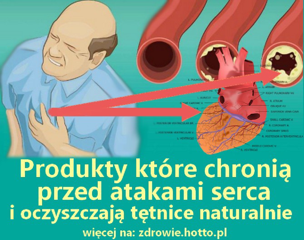 zdrowie.hotto.pl-te-produkty-chronia-przed-atakami-serca-oczyszczaja-tetnice-naturalnie